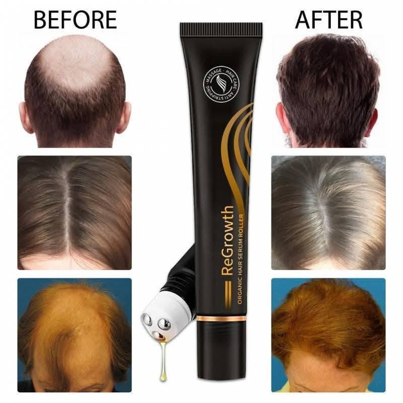 Regrowth Organic Hair Serum Roller Set, Biotin Hair Growth Serum